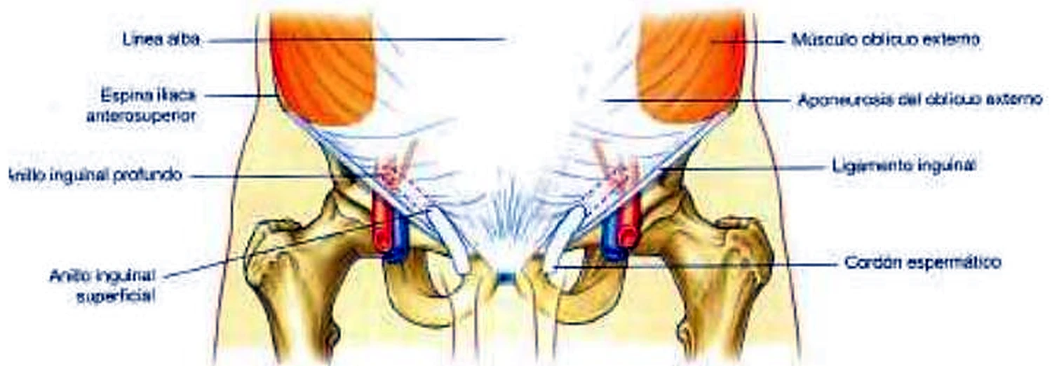 Imagen de las capas del conducto inguinal.