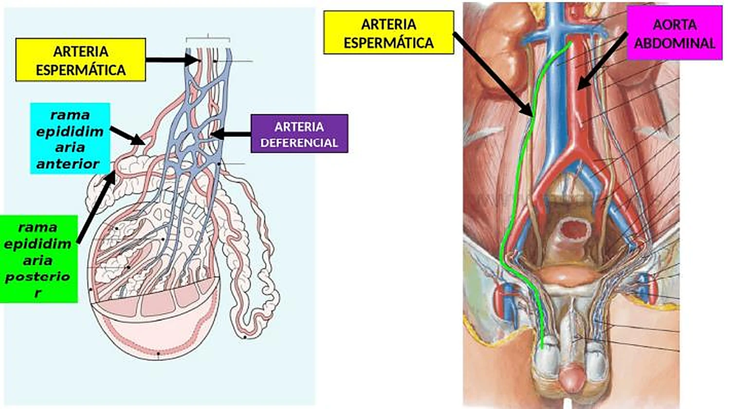 Imagen de la bifurcación de la aorta.