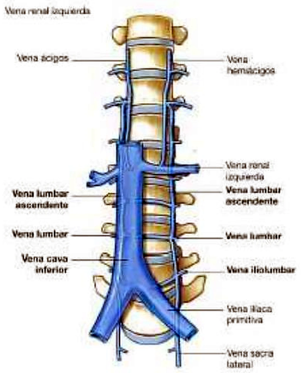 Esquema del sistema porta con las varices.