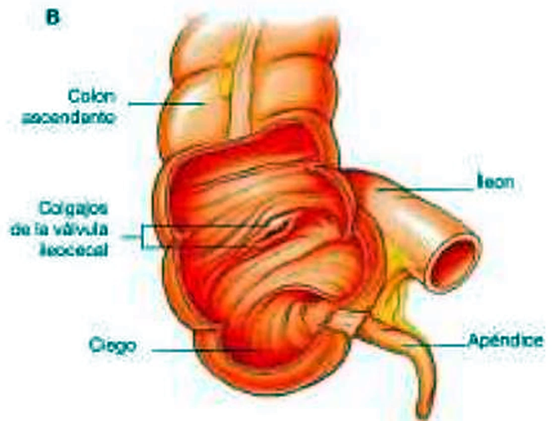 Esquema del ángulo ileocecal.