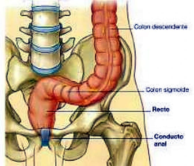 Imagen de la apendicitis.