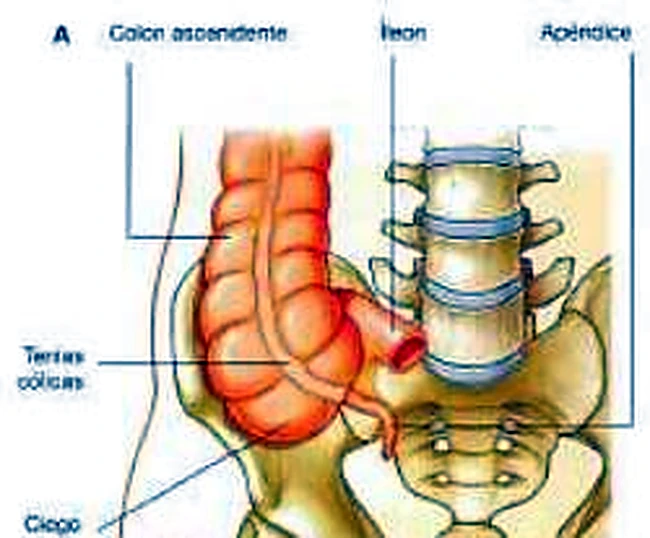 Imagen de las haustras del colon.