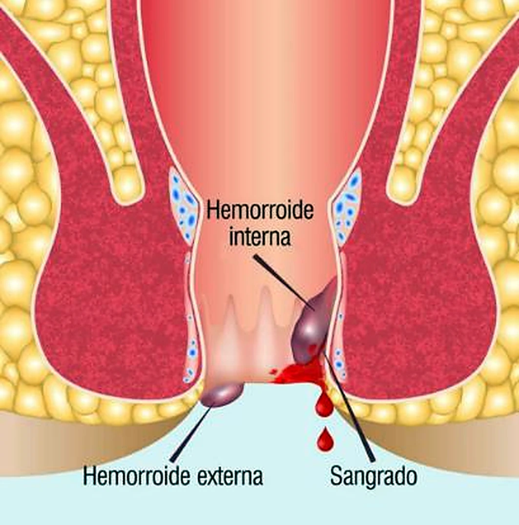Esquema de los esfínteres del ano.