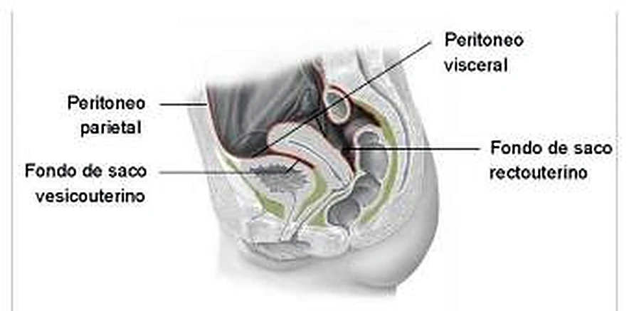 Imagen del ligamento ancho.