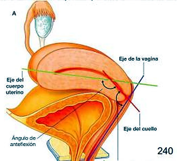 Esquema del útero.