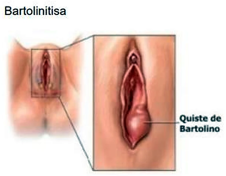 Imagen del clítoris.