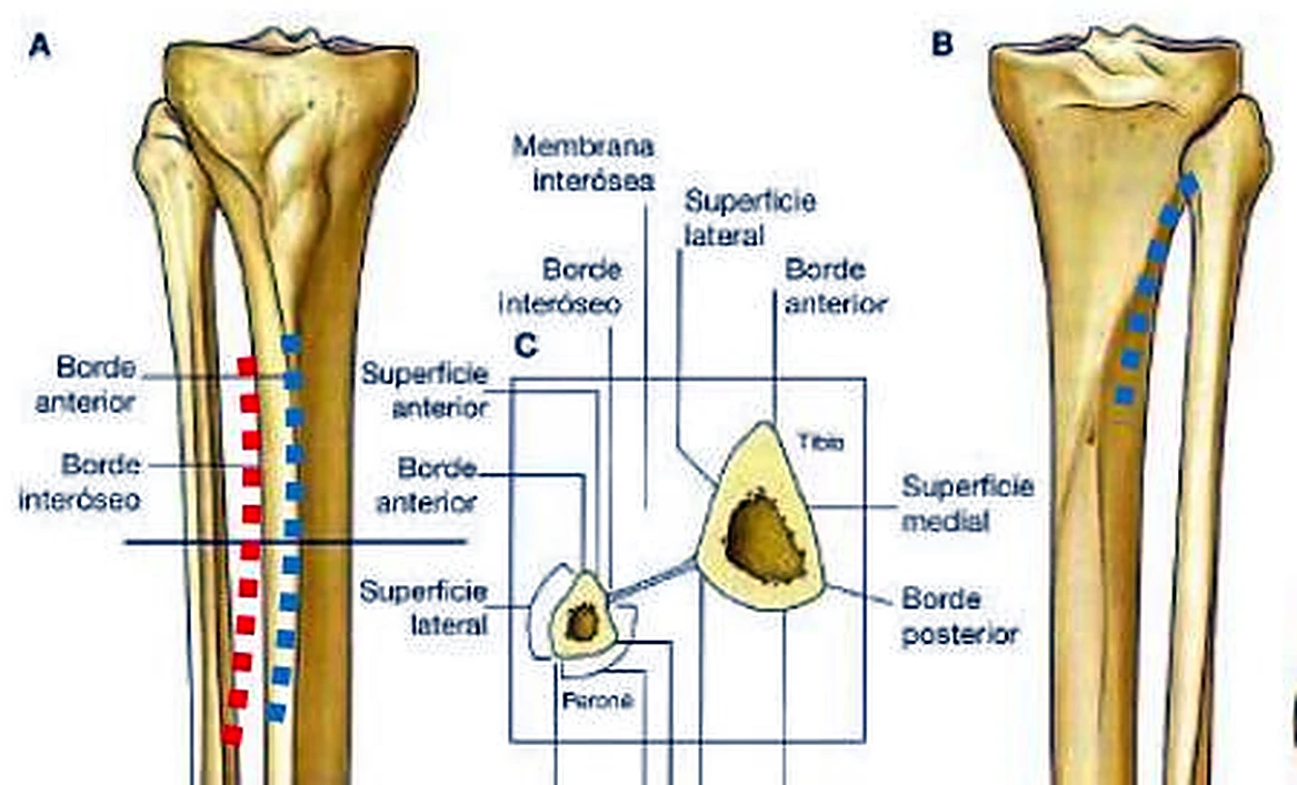 La tibia y el peroné uno junto al otro, con líneas discontinuas rojas y azules y en el centro cortes triangulares.