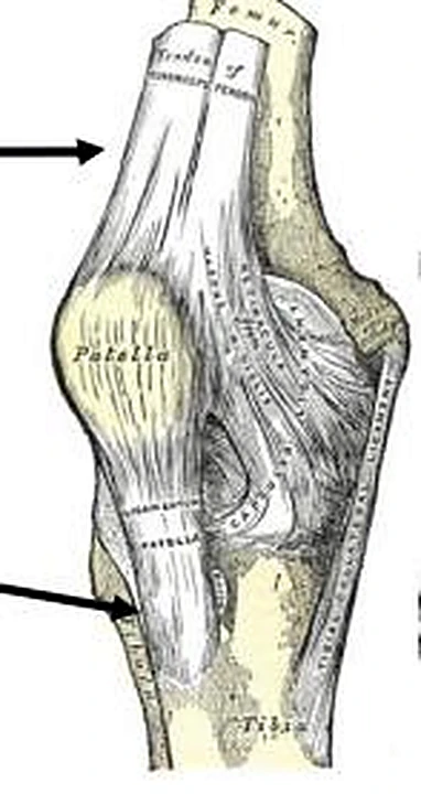 La articulación de la rodilla por delante en un dibujo en blanco y negro, con dos flechas negras.