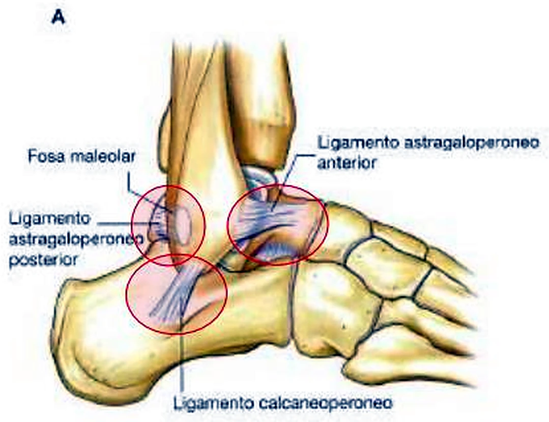 El tobillo de lado, con tres ligamentos en círculos rojos.