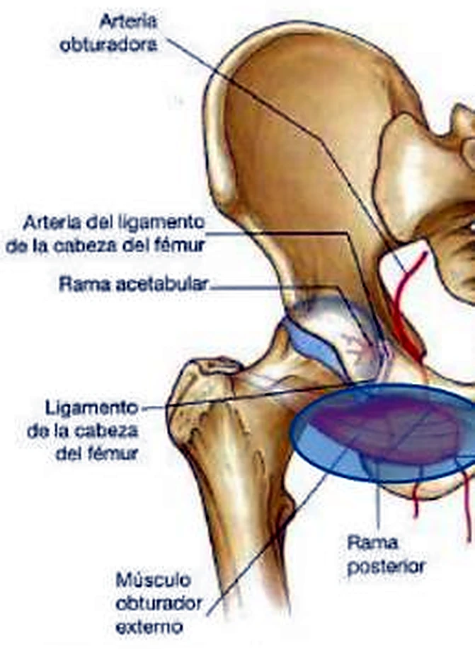 La cadera por delante, con arterias rojas finas y un músculo azul en el cuello del fémur.