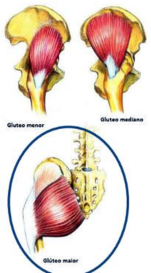 Tres pelvis pequeñas, en cada una un glúteo en rojo, y la de abajo dentro de un círculo azul.
