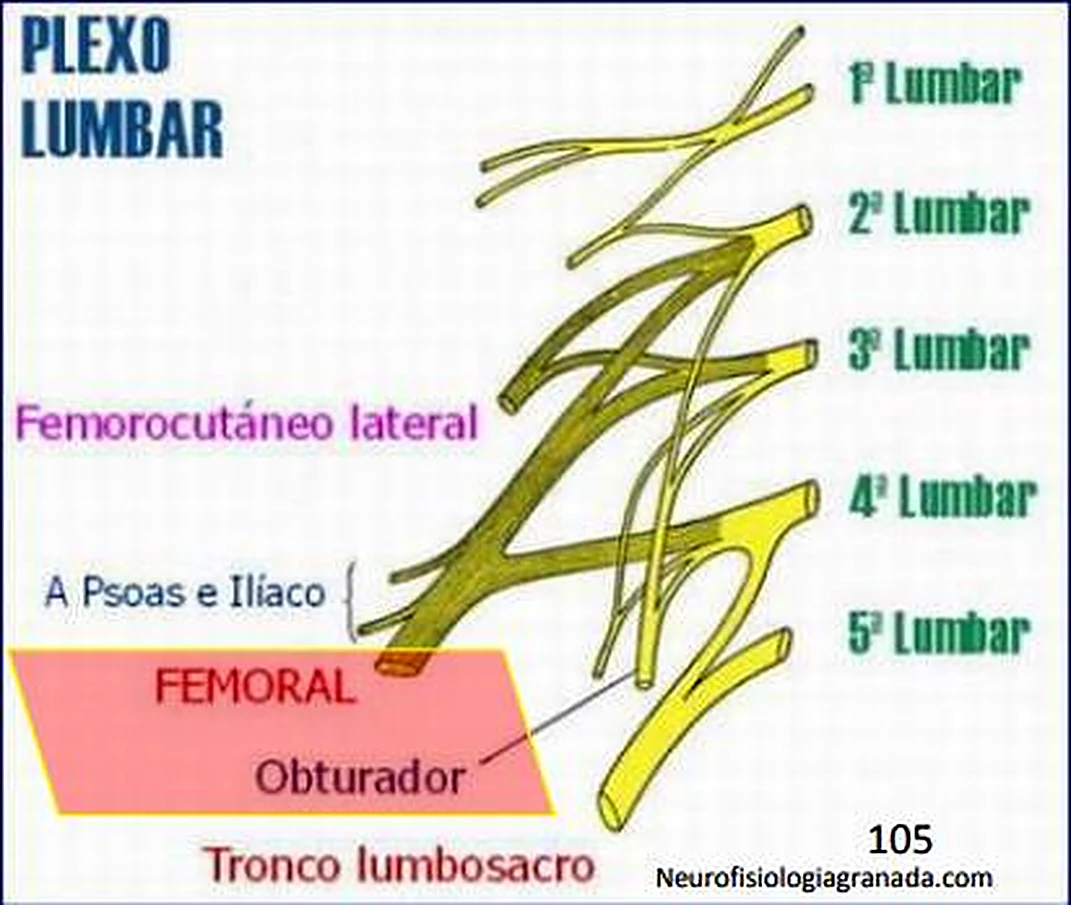 Nervios amarillos gruesos en un esquema, desde cuatro líneas lumbares hacia abajo y etiquetas de colores.