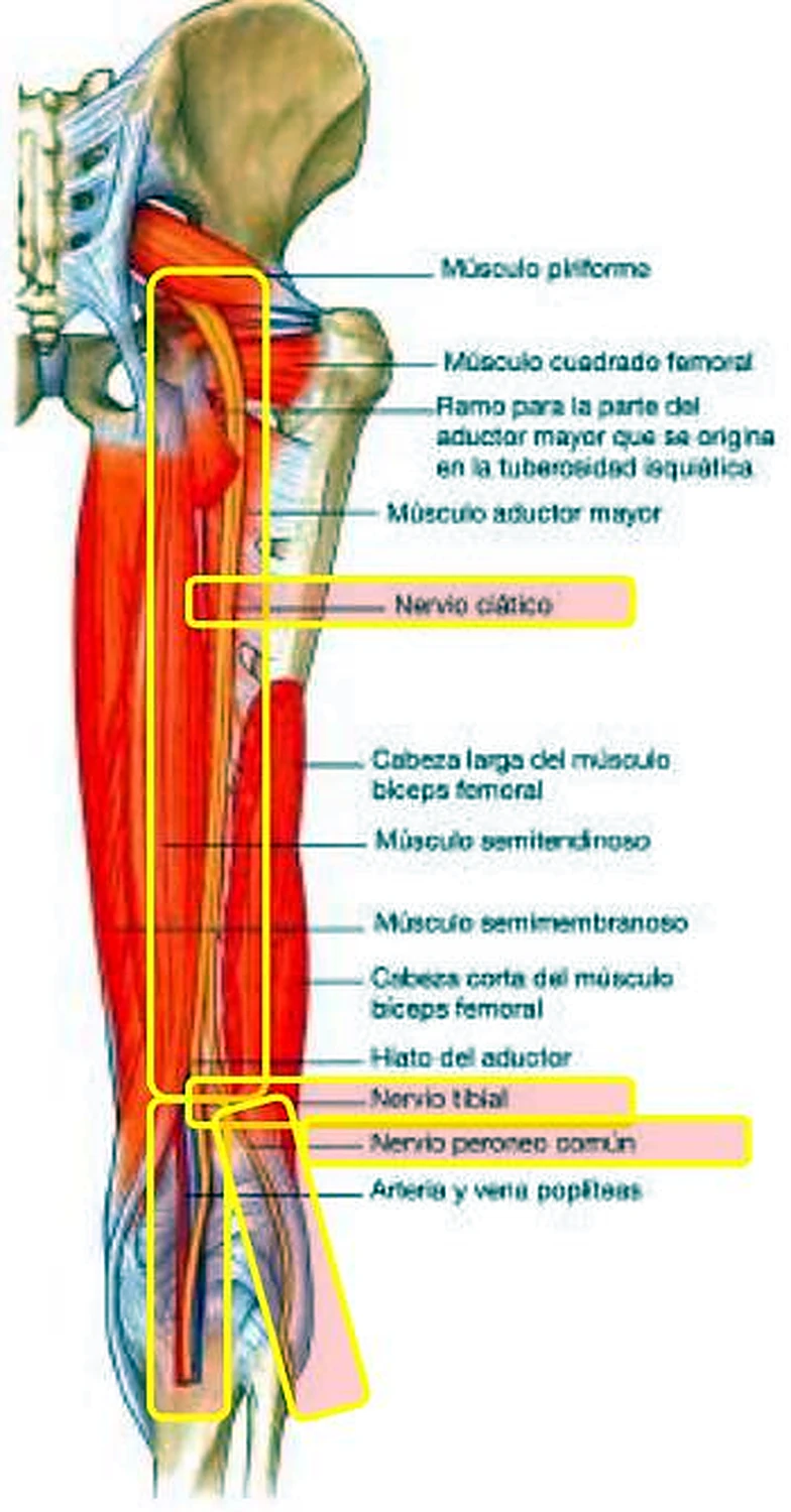 El muslo por detrás, con los músculos en rojo y un nervio alargado destacado con recuadros amarillos.