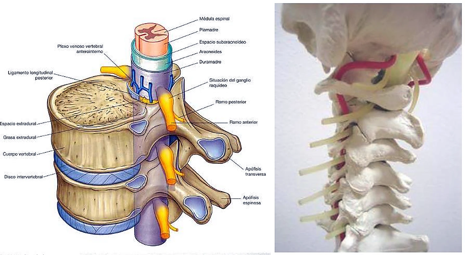 Dos vértebras y un disco seccionados, dentro la médula espinal con sus capas y a los lados nervios amarillos; al lado, una fotografía de la columna cervical.