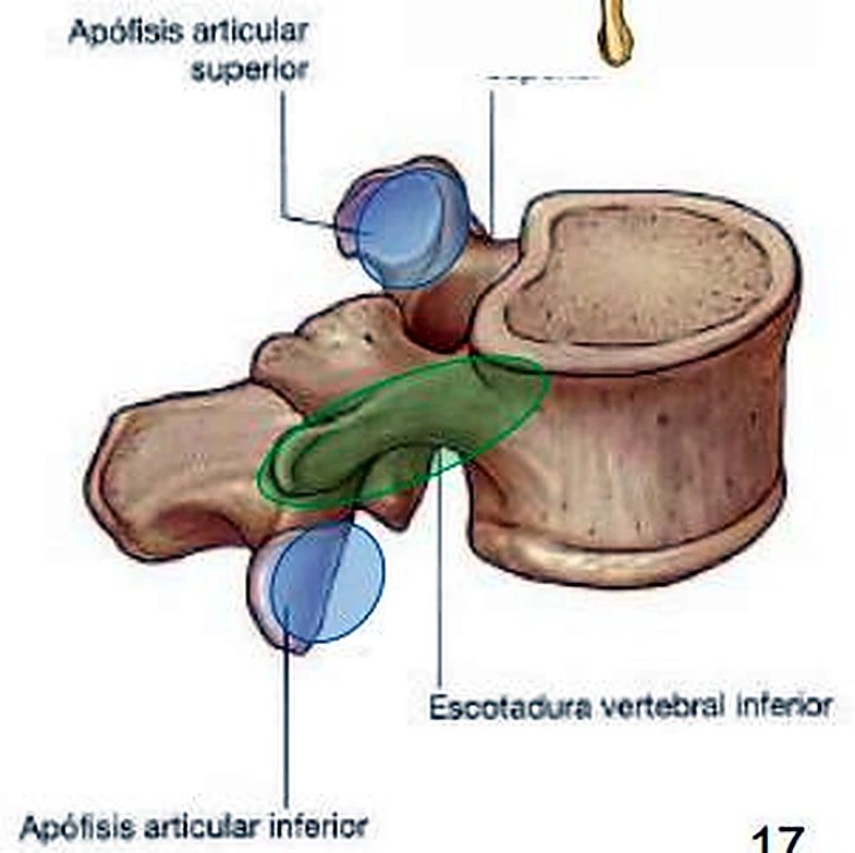 Una vértebra lumbar grande de lado, con dos superficies azules y una zona verde destacadas.