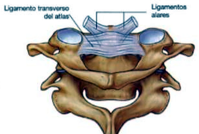 El atlas y el axis, con ligamentos azules cruzados sobre la apófisis odontoides.