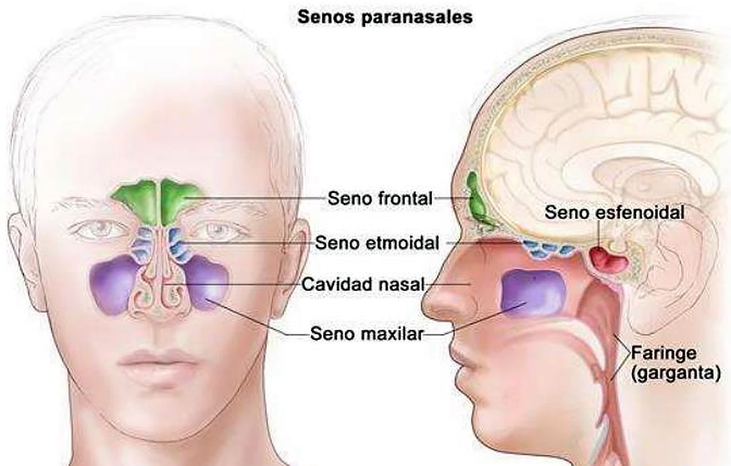 Imagen del drenaje de los senos.