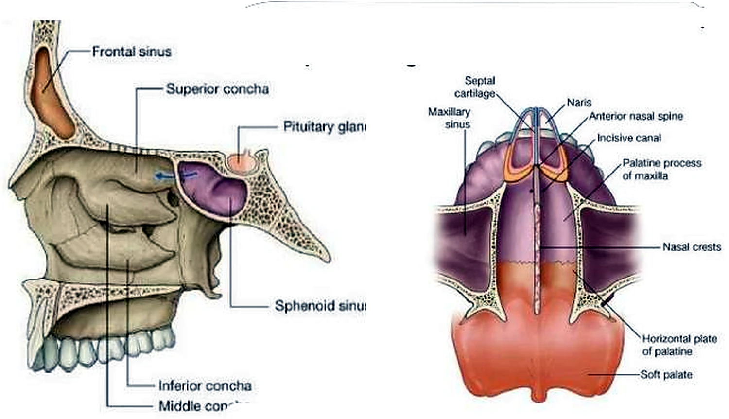 Imagen de la sinusitis.
