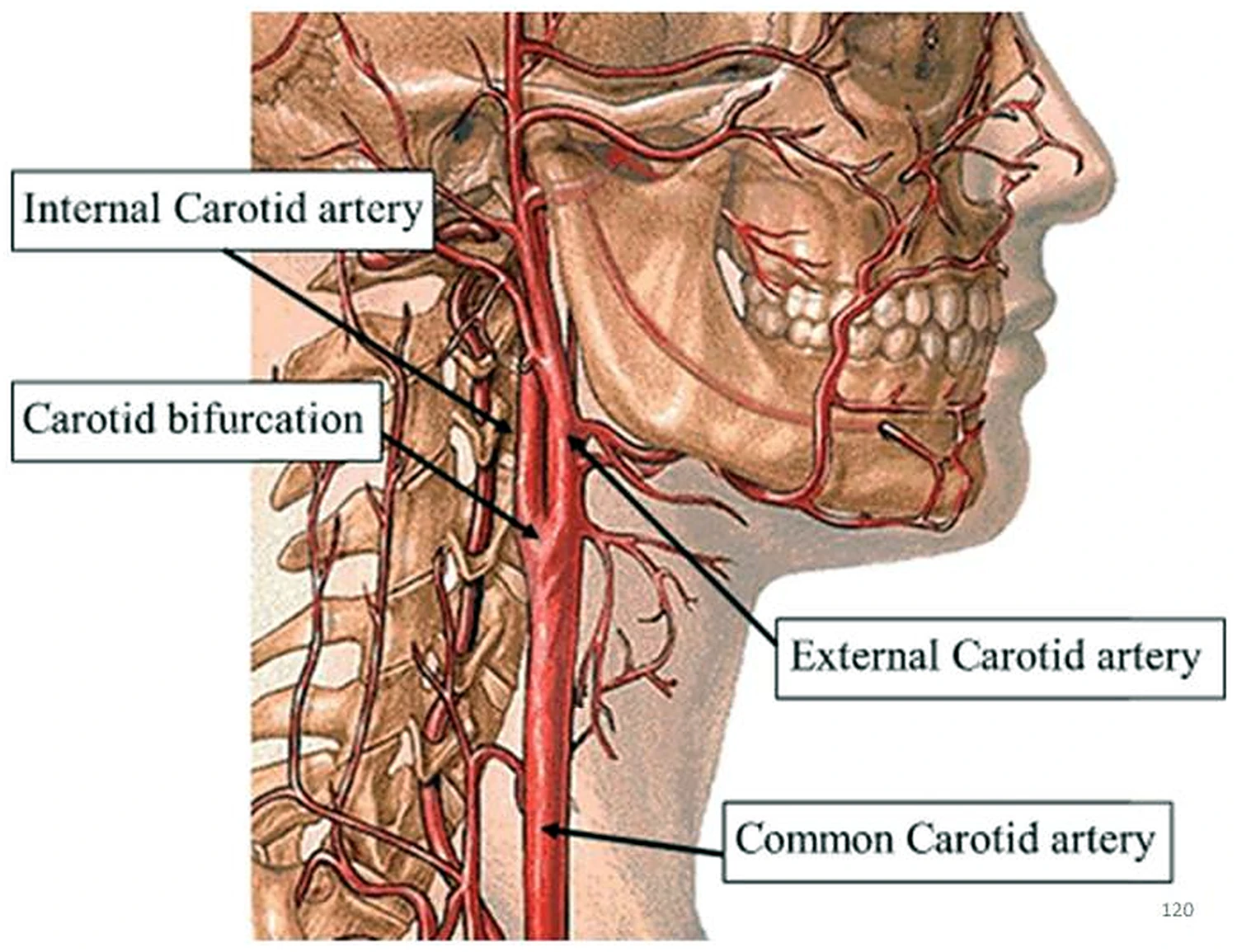 Imagen del cuerpo carotídeo.