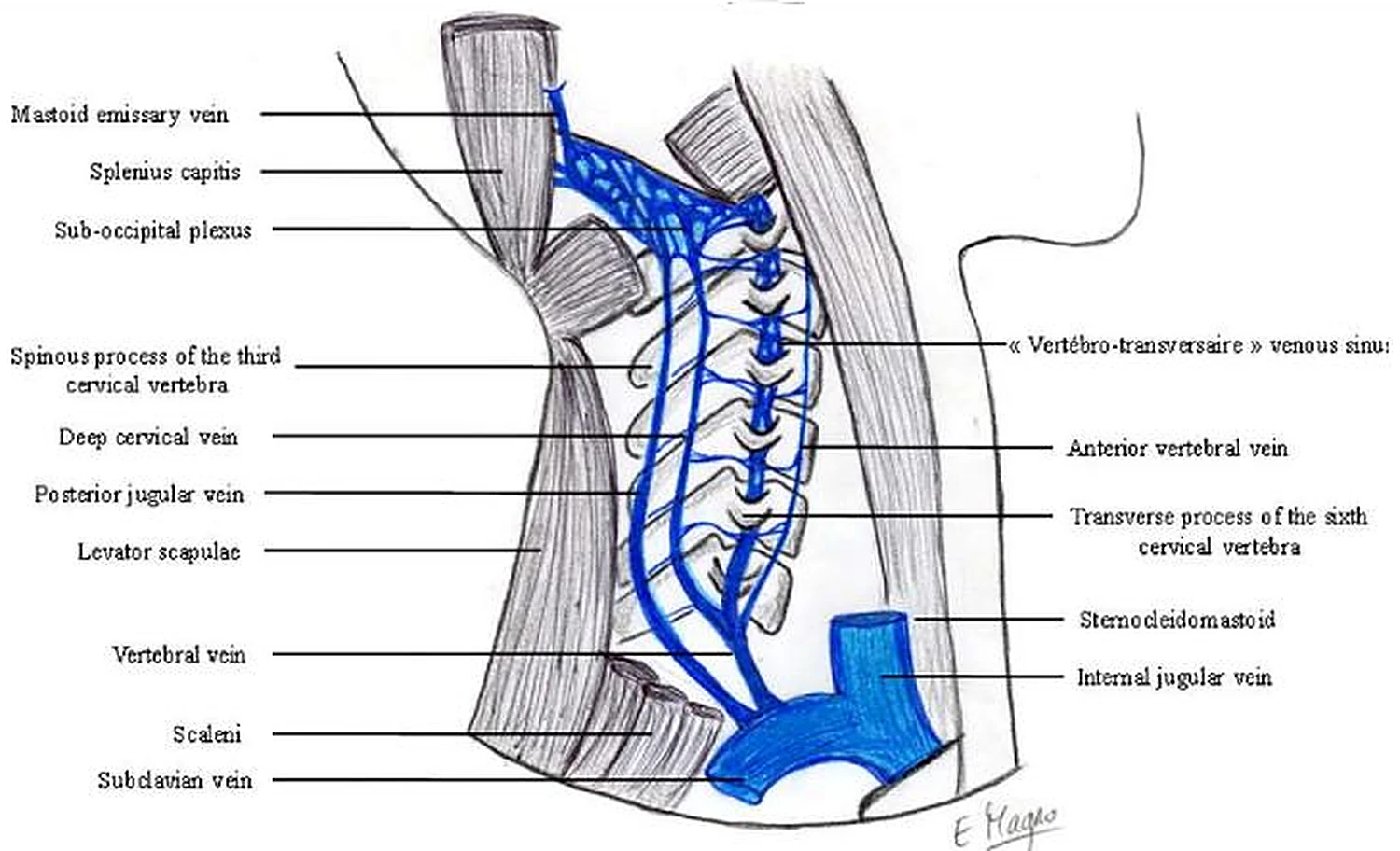Imagen de la yugular externa.