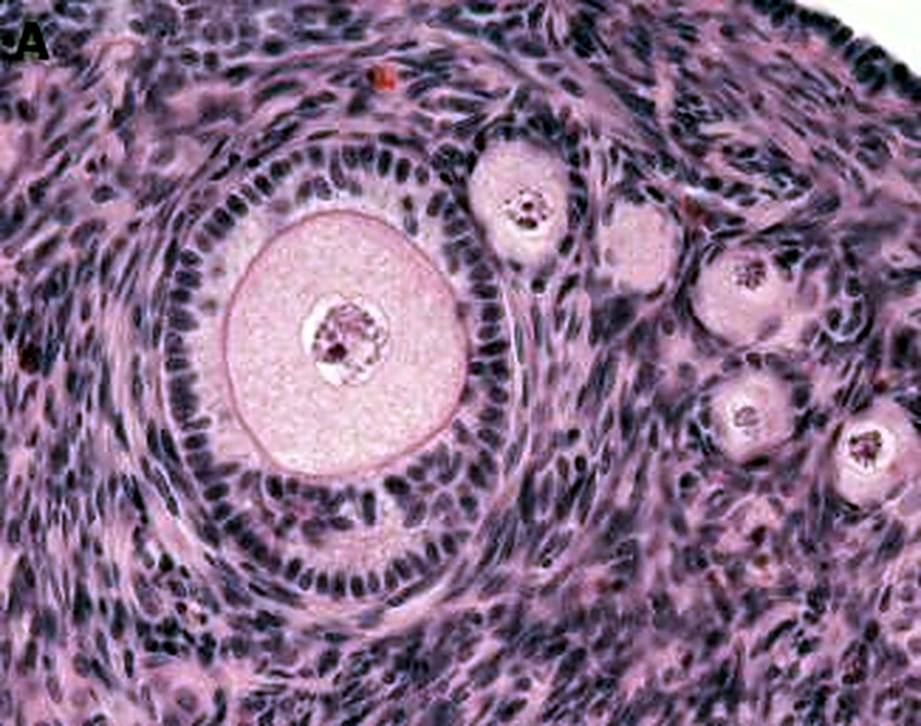 Imagen de microscopio en morado: en el centro una célula grande rodeada por un anillo claro.