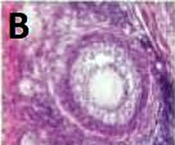 Imagen de microscopio: una célula redonda rodeada por una capa de células.