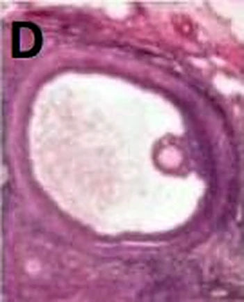 Imagen de microscopio: un gran hueco y en el borde un grupo de células.