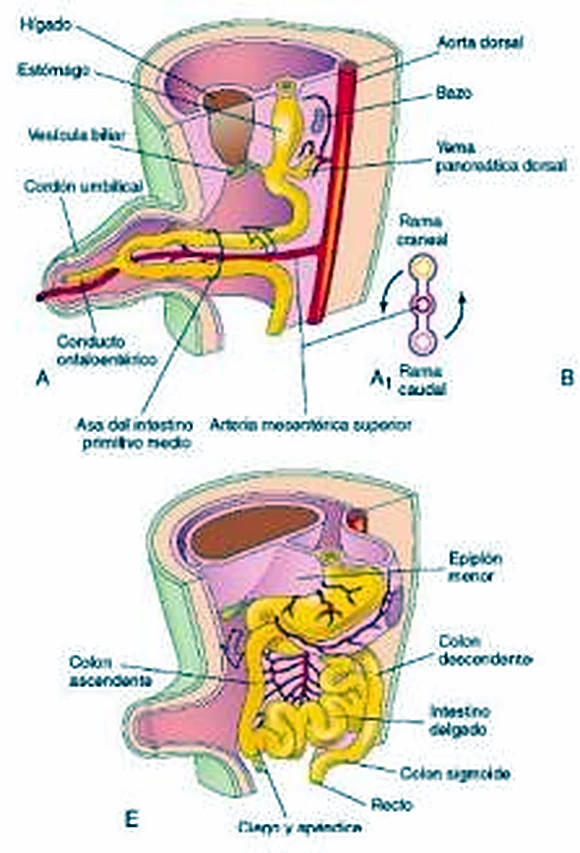Tres esquemas: los órganos internos en amarillo y rosa, con un asa intestinal.