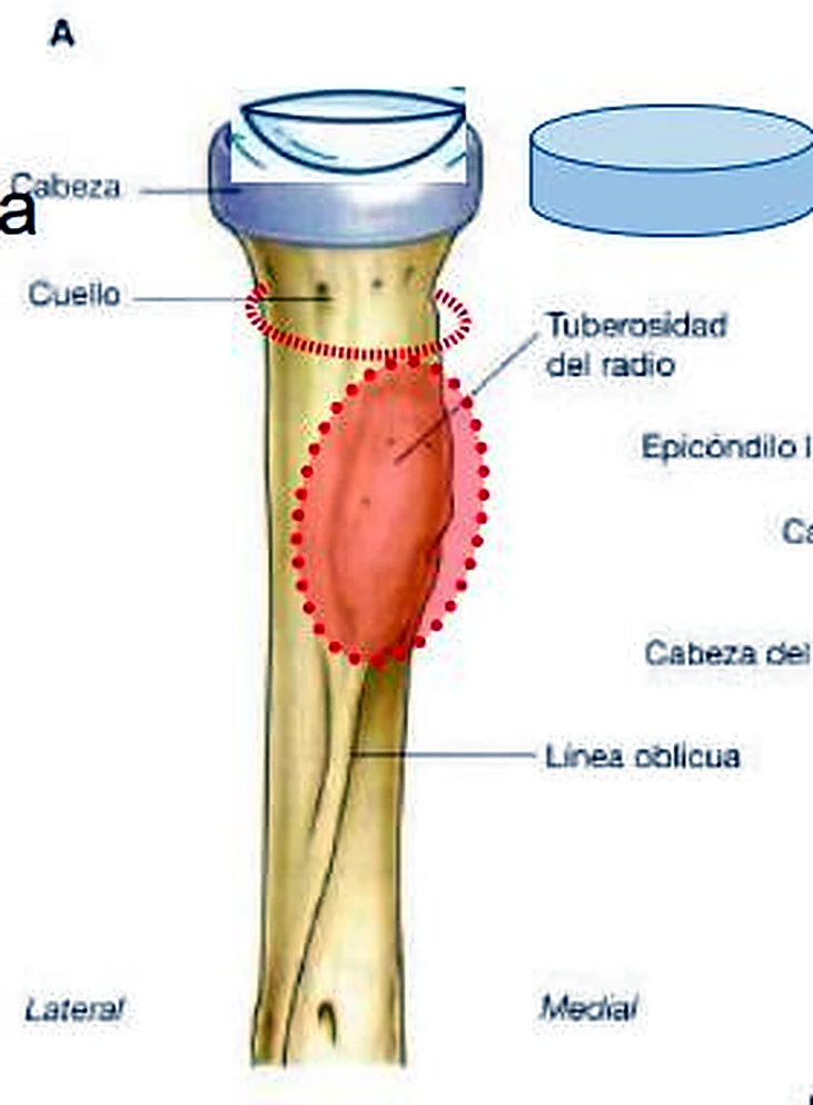 La parte superior del radio, con la cabeza comparada con la imagen de un disco y la tuberosidad en rojo.
