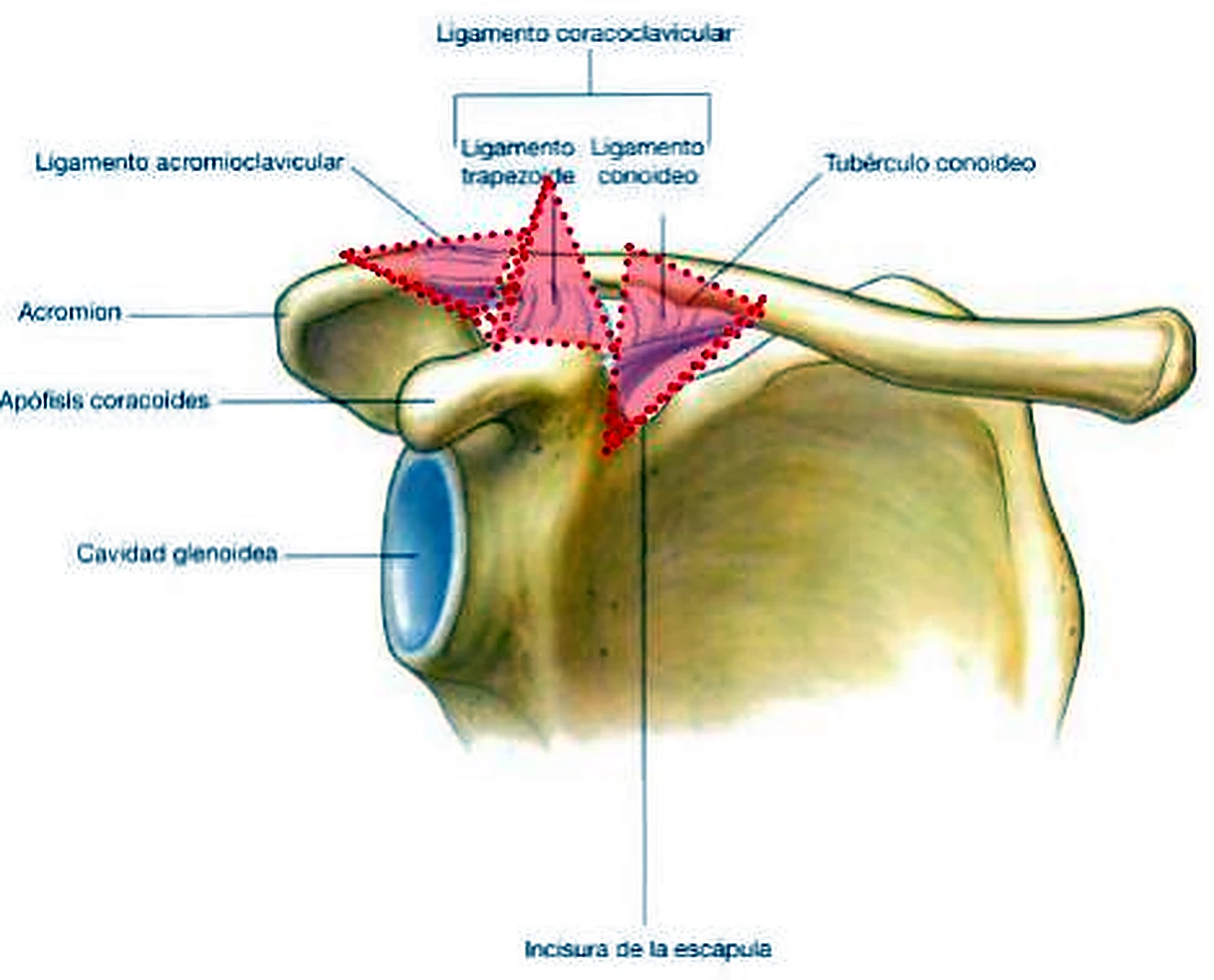 La parte superior de la escápula con la clavícula, con los ligamentos marcados en rojo.