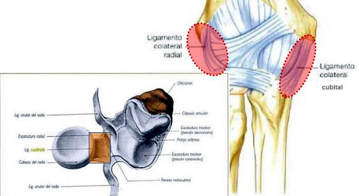 Dos dibujos del codo, con la zona de cada ligamento rodeada en rojo.