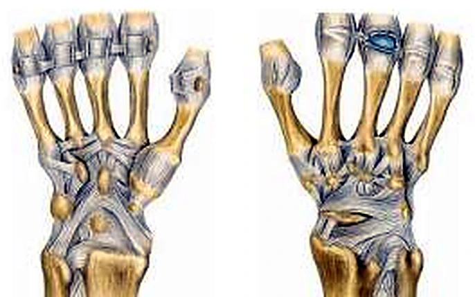 Dos esqueletos de la mano cubiertos de ligamentos azules, uno por delante y otro por detrás.