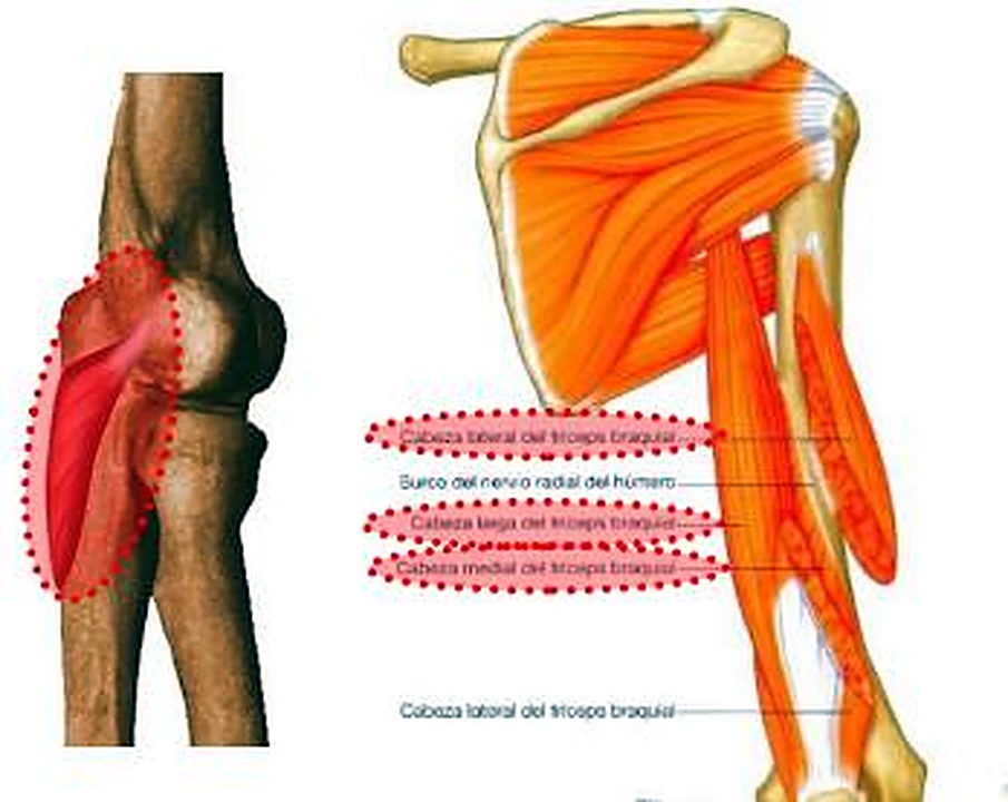 Dos imágenes: la fotografía del codo y el brazo por detrás con los músculos.