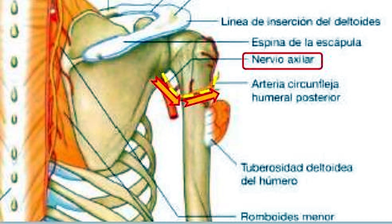 El hombro por detrás, con el nervio marcado con una flecha amarilla alrededor del cuello del húmero.