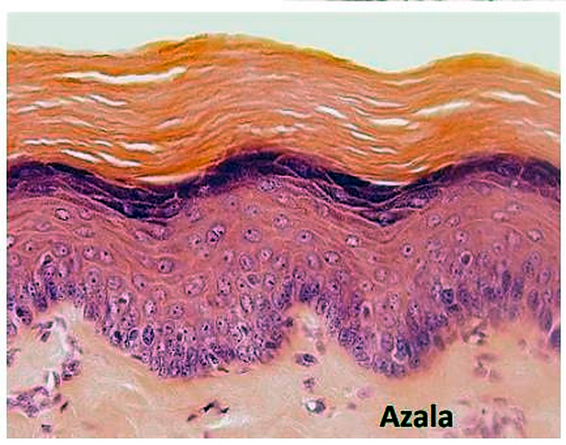 Imagen de microscopio: arriba una banda naranja ondulada, debajo una capa de células moradas y conectivo rosado.