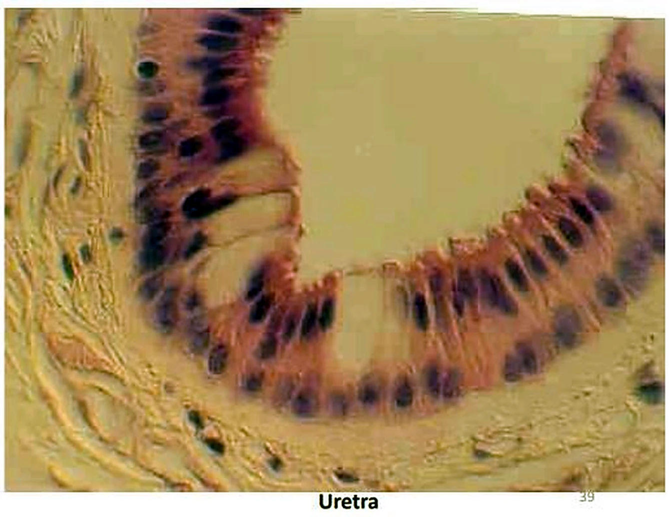 Imagen de microscopio: una luz clara y una banda gruesa de núcleos oscuros alrededor.