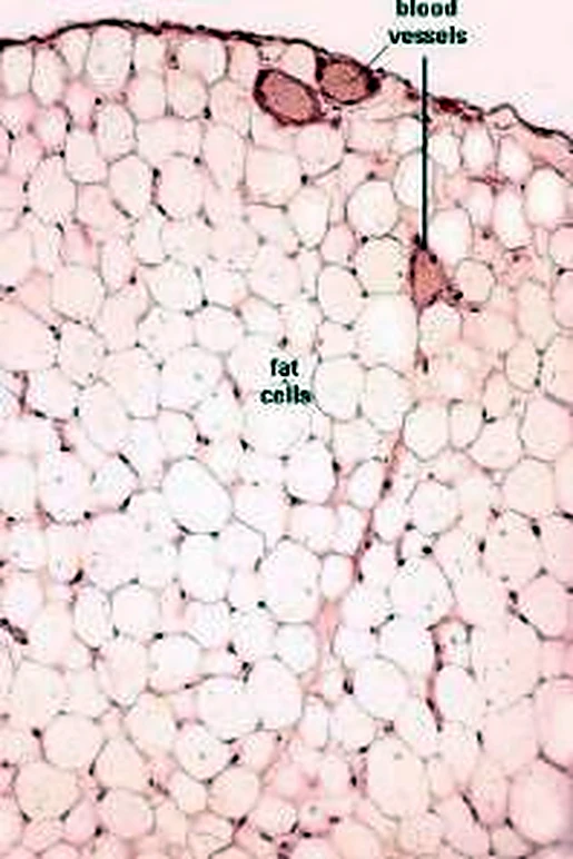 Imagen de microscopio: abundantes células blancas y redondas y arriba algunos vasos.