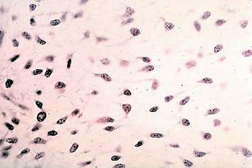 Imagen de microscopio: sobre un fondo claro, abundantes células pequeñas, oscuras y alargadas.