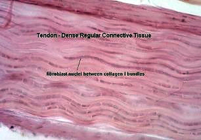 Imagen de microscopio: bandas rosadas onduladas y paralelas y núcleos alargados y oscuros en hileras.