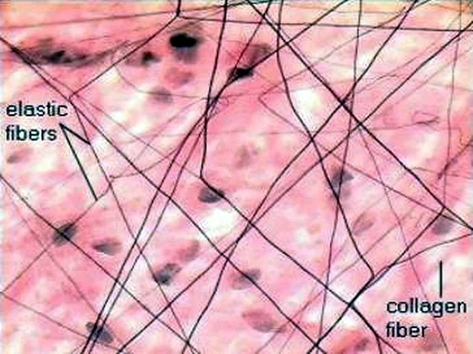 Imagen de microscopio: fondo rosado y líneas negras finas entrecruzadas.