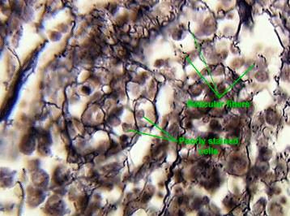 Imagen de microscopio: marrón y negro, una red fina y células claras.