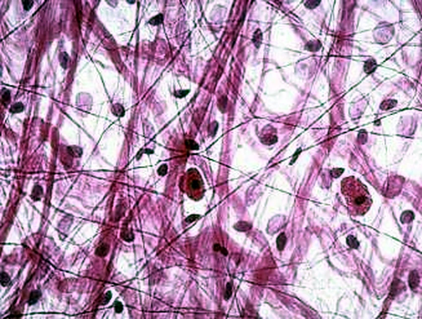 Imagen de microscopio: fibras rosadas y oscuras en todas las direcciones, y núcleos pequeños.
