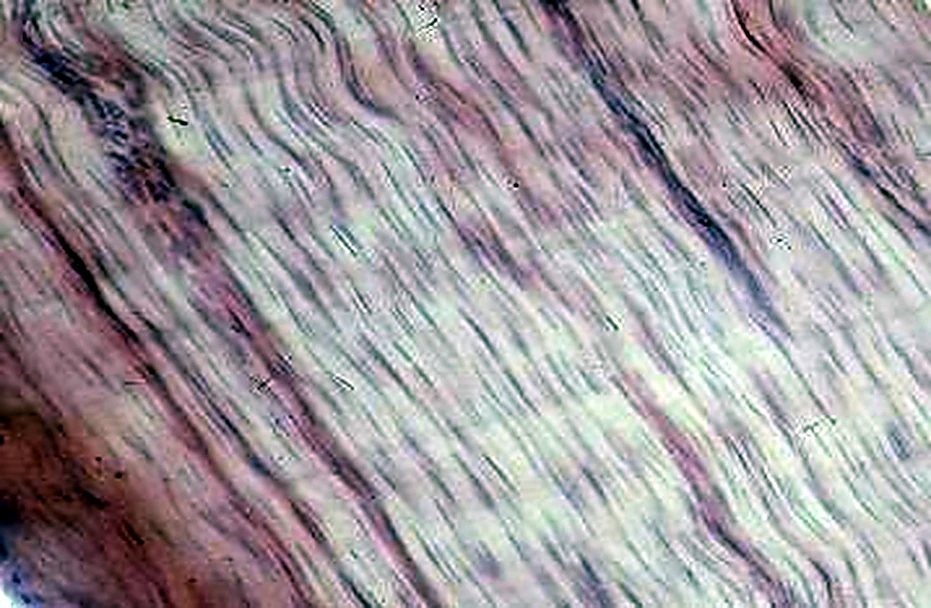 Imagen de microscopio: bandas paralelas oblicuas, con pequeñas ondas.