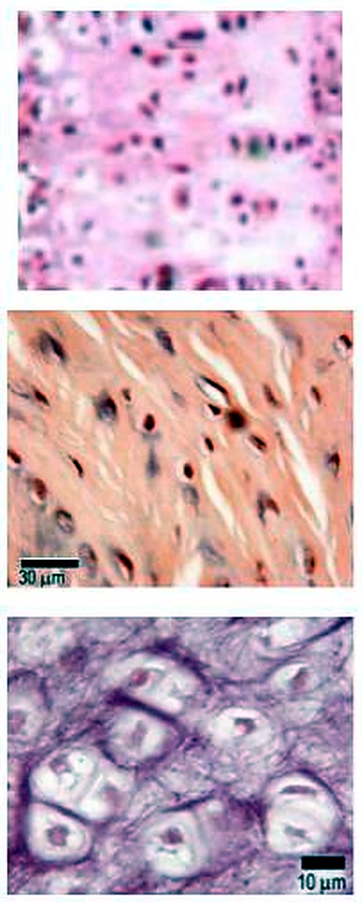 Tres pequeñas imágenes de microscopio una debajo de otra: rosada, naranja con fibras y morada con células grandes.