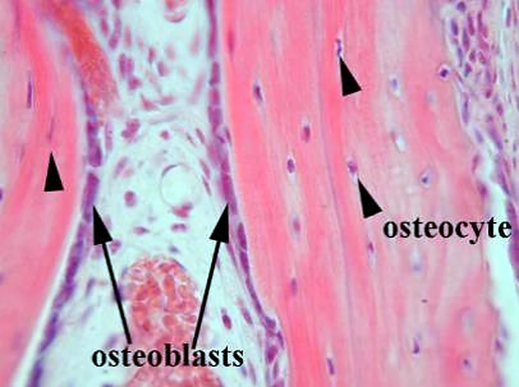 Imagen de microscopio: grandes bandas rosadas y células moradas en el borde y dentro, con flechas.