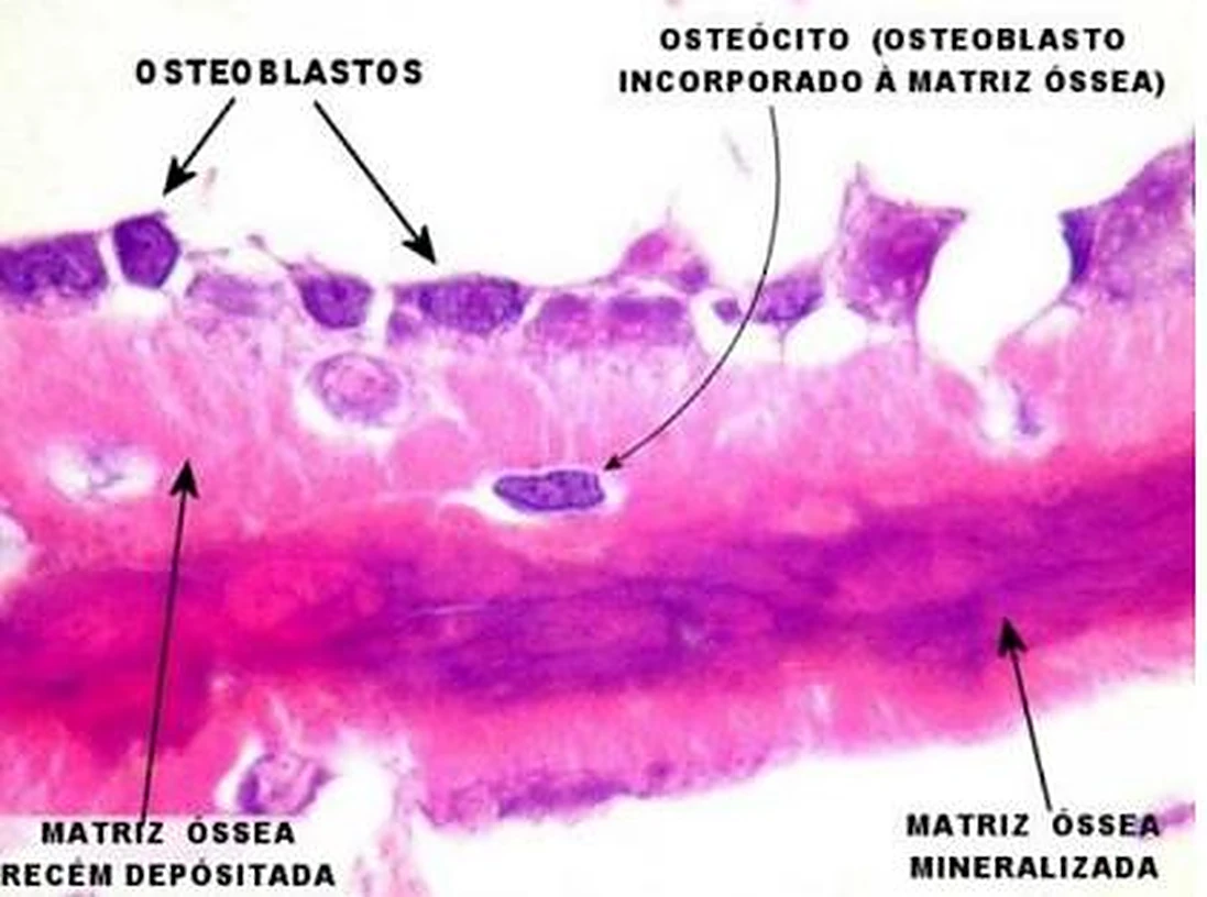Imagen de microscopio: células moradas oscuras en fila y debajo una banda morada mineralizada.