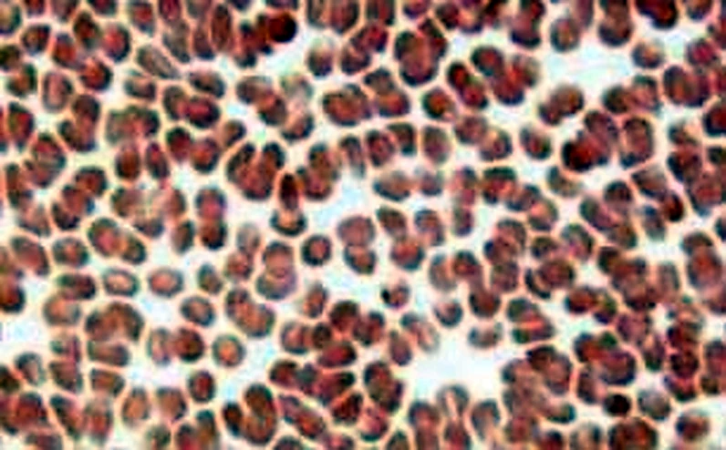 Imagen de microscopio: abundantes círculos pardo rojizos muy juntos.