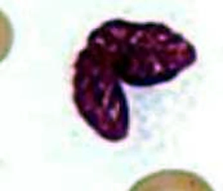Una célula grande con un núcleo morado plegado.