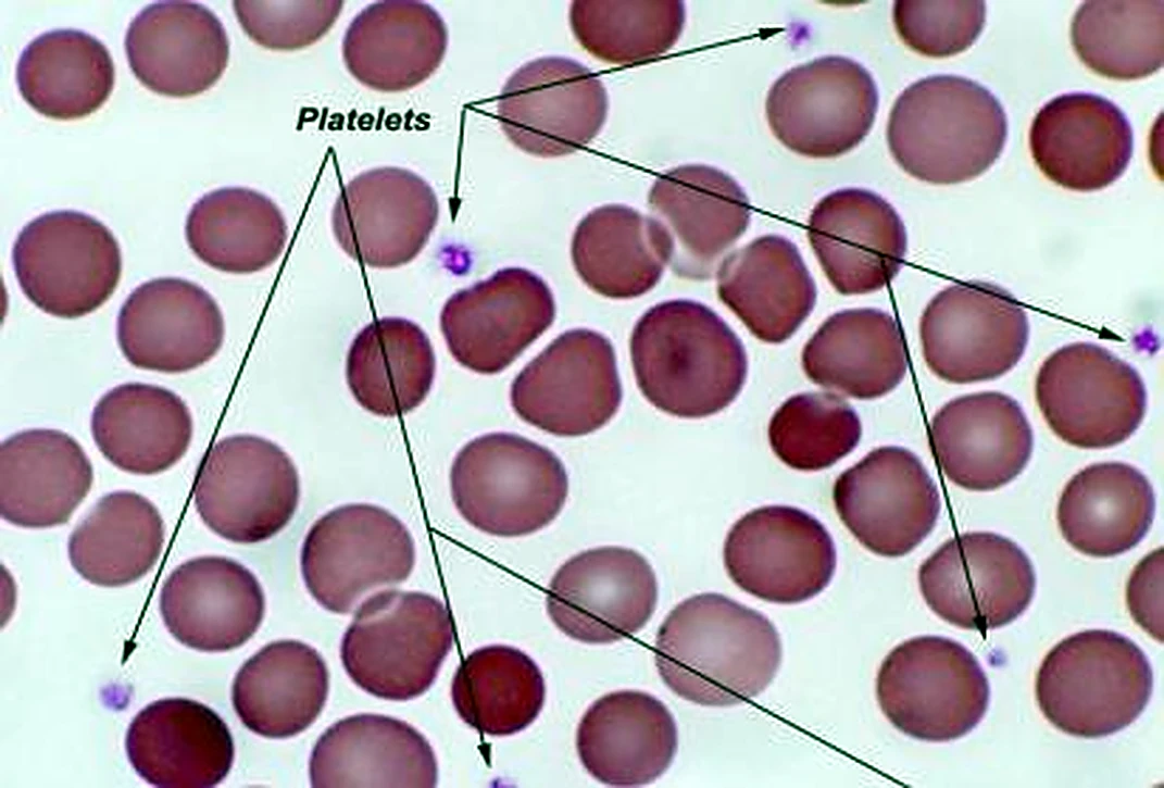 Imagen de microscopio: abundantes círculos rojos y entre ellos pequeños puntos morados con flechas.