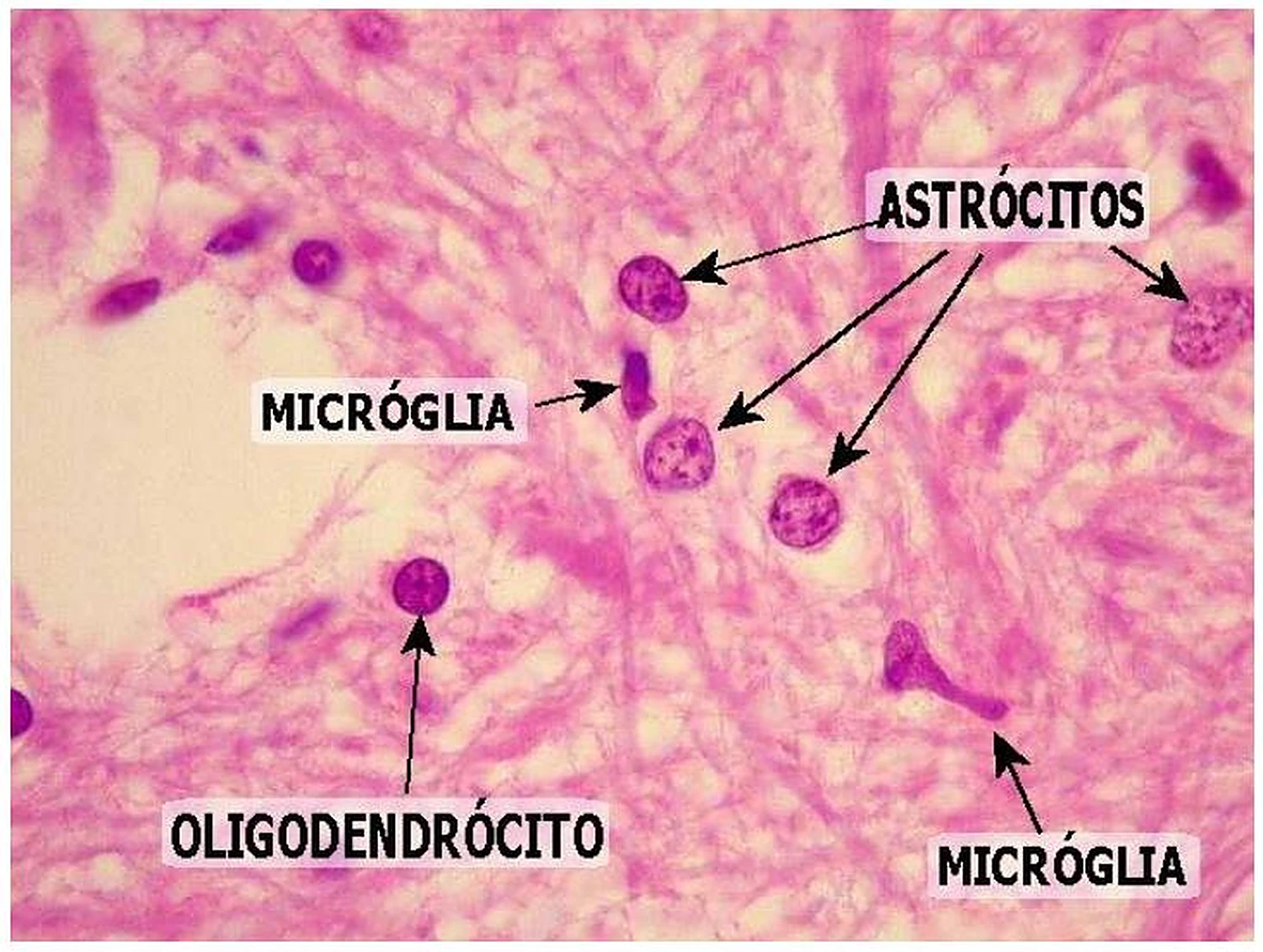 Una imagen de microscopio rosada, con células moradas señaladas con flechas y nombres.